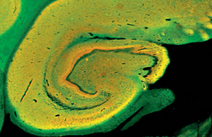 IHC: Localization of syntaxin (green) and synaptophysin (red) in human hippocampus (paraffin-embedded section).
