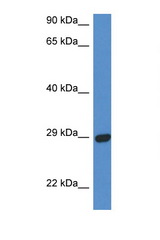 STX2 / Syntaxin 2 antibody LS-C145304 Western blot of Fetal Heart lysate. Antibody concentration 1 ug/ml.