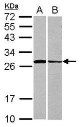 Sample (30 ug of whole cell lysate) A: HeLa B: HCT116 12% SDS PAGE STX3 / Syntaxin 3 antibody diluted at 1:1000
