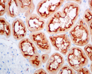 IHC of paraffin-embedded human kidney tissue using anti-STX3 / Syntaxin 3 antibody.