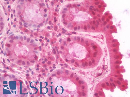 Anti-STX4 / Syntaxin 4 antibody IHC staining of human colon. Immunohistochemistry of formalin-fixed, paraffin-embedded tissue after heat-induced antigen retrieval. Antibody LS-B9936 dilution 1:100.