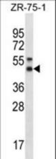 STX5 Antibody western blot of ZR-75-1 cell line lysates (35 ug/lane). The STX5 antibody detected the STX5 protein (arrow).
