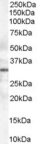 Antibody (0.3 ug/ml) staining of human lymph node lysate (35 ug protein in RIPA buffer). Primary incubation was 1 hour. Detected by chemiluminescence.