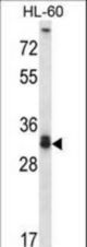 STX6 Antibody western blot of HL-60 cell line lysates (35 ug/lane). The STX6 antibody detected the STX6 protein (arrow).