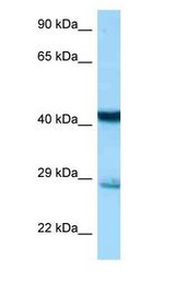 STX7 / Syntaxin 7 antibody Western Blot of Mouse Liver.