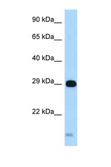STX8 / Syntaxin 8 antibody LS-C145991 Western blot of Fetal Heart lysate. Antibody concentration 1 ug/ml.