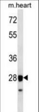 STX8 Antibody western blot of mouse heart tissue lysates (35 ug/lane). The STX8 antibody detected the STX8 protein (arrow).