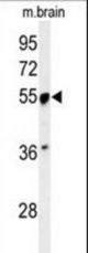 Western blot of PRPF19 Antibody in mouse brain tissue lysates (35 ug/lane). PRPF19 (arrow) was detected using the purified antibody.