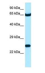 STXBP3 antibody Western Blot of NCI-H226.