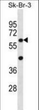 STXBP3 Antibody western blot of SK-BR-3 cell line lysates (35 ug/lane). The STXBP3 antibody detected the STXBP3 protein (arrow).