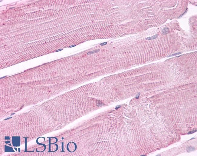 Anti-PTPRA antibody IHC of human skeletal muscle. Immunohistochemistry of formalin-fixed, paraffin-embedded tissue after heat-induced antigen retrieval. Antibody LS-A6794 dilution 4 ug/ml.
