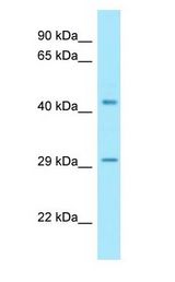 SUCLA2 antibody Western Blot of Fetal Heart.