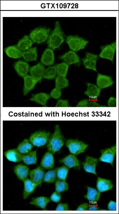 Immunofluorescence of methanol-fixed A431 using SUCLA2 antibody at 1:200 dilution.