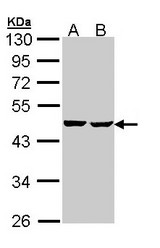 Sample (30 ug of whole cell lysate). A: Hep G2 , B: Molt-4 . 10% SDS PAGE. SUCLA2 antibody diluted at 1:1000.
