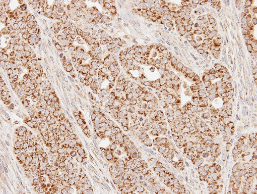 IHC of paraffin-embedded N87 xenograft using SUCLG1 antibody at 1:100 dilution.