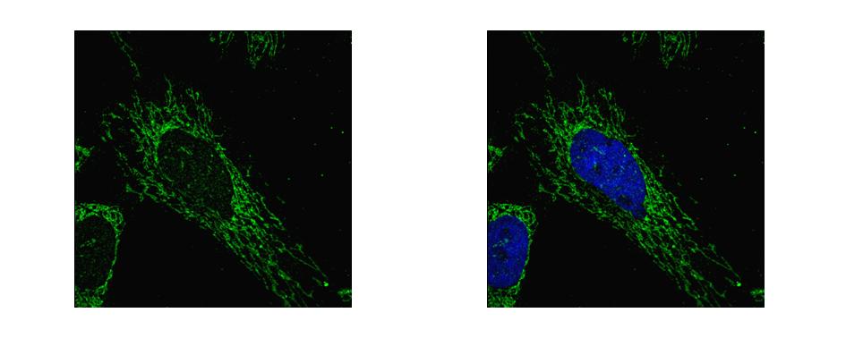 SUCLG1 antibody detects SUCLG1 protein at mitochondria by confocal immunofluorescent analysis. HeLa cells were fixed in 2% paraformaldehyde/culture medium at 37 for 30 min. SUCLG1 protein stained by SUCLG1 antibody diluted at 1:500.