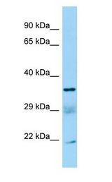 SUCLG1 / GALPHA antibody Western Blot of U937.