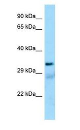 SUCLG1 / GALPHA antibody Western Blot of Human Lung.