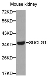 Western blot analysis of extracts of Mouse kidney cell lines, using SUCLG1 antibody.