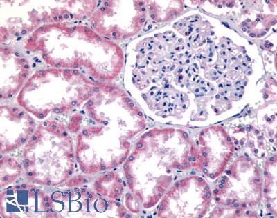 Anti-GPR91 antibody LS-A3476 IHC of human kidney. Immunohistochemistry of formalin-fixed, paraffin-embedded tissue after heat-induced antigen retrieval.