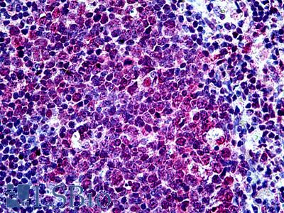 Anti-SUFU antibody IHC of human tonsil. Immunohistochemistry of formalin-fixed, paraffin-embedded tissue after heat-induced antigen retrieval. Antibody LS-B5105 concentration 3.75 ug/ml.