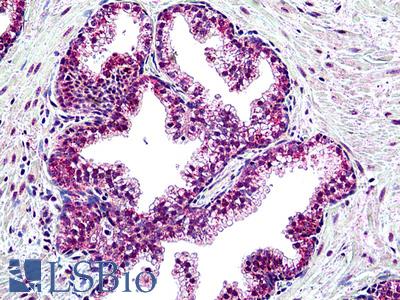 Anti-SUFU antibody IHC of human prostate. Immunohistochemistry of formalin-fixed, paraffin-embedded tissue after heat-induced antigen retrieval. Antibody LS-B5105 concentration 3.75 ug/ml.