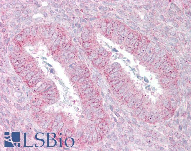 Anti-SUFU antibody IHC of human uterus. Immunohistochemistry of formalin-fixed, paraffin-embedded tissue after heat-induced antigen retrieval. Antibody LS-B6811 concentration 5 ug/ml.