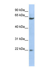 SUFU antibody LS-B6811 Western blot of HepG2 cell lysate.