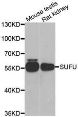 Western blot analysis of extracts of various cell lines, using SUFU antibody.