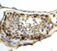 IHC of paraffin-embedded human testis using anti-SuFu antibody (LS-C105384).