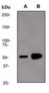 Western blot analysis on (A) HeLa and (B) Human kidney lysate using anti-SuFu antibody (LS-C105384), dilution 1:2000.