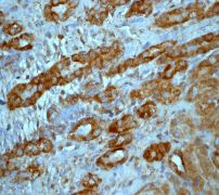 IHC of paraffin-embedded human fetal kidneys using anti-SuFu antibody.
