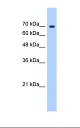 HepG2 cell lysate. Antibody concentration: 0.5 ug/ml. Gel concentration: 12%.