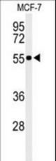 Western blot of PRPF19 Antibody in MCF-7 cell line lysates (35 ug/lane). PRPF19 (arrow) was detected using the purified antibody.