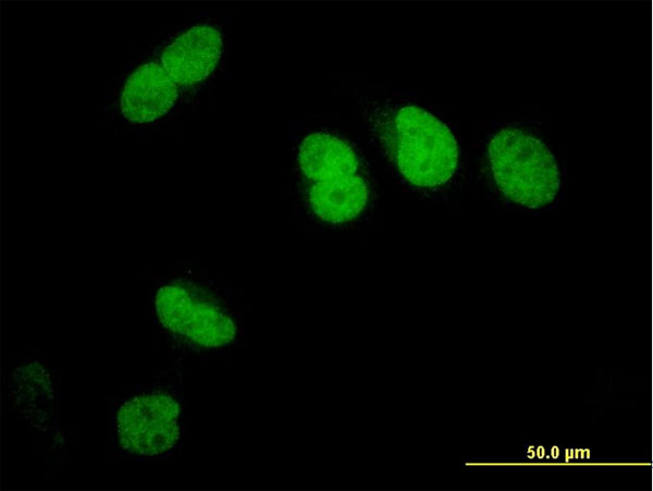 Immunofluorescence of monoclonal antibody to SFRS14 on HeLa cell. [antibody concentration 10 ug/ml]