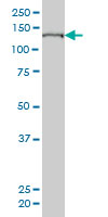 SFRS14 monoclonal antibody (M01), clone 3C5 Western blot of SFRS14 expression in HeLa NE.