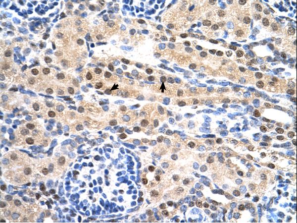 SULF2 / Sulfatase 2 antibody LS-C81365 was used in IHC to stain formalin-fixed, paraffin-embedded human kidney.