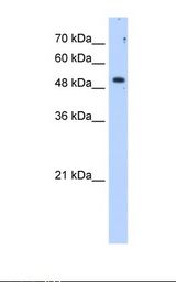 HepG2 cell lysate. Antibody concentration: 1.25 ug/ml. Gel concentration: 12%.