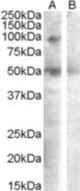 SULF2 antibody (0.3 ug/ml) staining of Human Ovary lysate (35 ug protein/ml in RIPA buffer) with (B) and without (A) blocking with the immunizing peptide. Primary incubation was 1 hour. Detected by chemiluminescence.