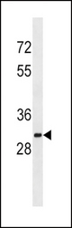 SULT1A2 Antibody western blot of K562 cell line lysates (35 ug/lane). The SULT1A2 antibody detected the SULT1A2 protein (arrow).