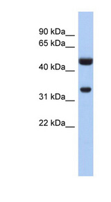 SULT1B1 antibody LS-C111191 Western blot of Fetal Intestine lysate.