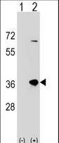 Western blot of SULT1B1 (arrow) using rabbit polyclonal SULT1B1 Antibody. 293 cell lysates (2 ug/lane) either nontransfected (Lane 1) or transiently transfected (Lane 2) with the SULT1B1 gene.