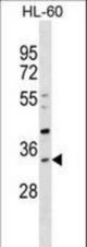 SULT1B1 Antibody western blot of HL-60 cell line lysates (35 ug/lane). The SULT1B1 antibody detected the SULT1B1 protein (arrow).