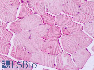 Anti-PTPRA antibody IHC of human skeletal muscle. Immunohistochemistry of formalin-fixed, paraffin-embedded tissue after heat-induced antigen retrieval. Antibody LS-A6792 dilution 10 ug/ml.