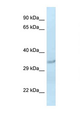 SULT1C2 antibody LS-C145549 Western blot of Rat Liver lysate. Antibody concentration 1 ug/ml.