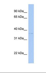 Hela cell lysate. Antibody concentration: 1.0 ug/ml. Gel concentration: 12%.