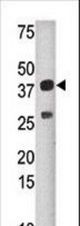 Western blot of anti-SULT1C2 antibody in mouse liver tissue lysate (35 ug/lane). SULT1C2(arrow) was detected using the purified antibody.