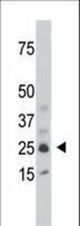 The anti-SULT1C1 antibody is used in Western blot to detect SULT1C1 in mouse kidney tissue lysate.