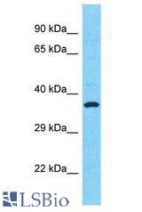 SULT1C2 antibody Western Blot of HT1080. Antibody dilution: 1 ug/ml.