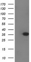 HEK293T cells were transfected with the pCMV6-ENTRY control (Left lane) or pCMV6-ENTRY SULT1C2 (Right lane) cDNA for 48 hrs and lysed. Equivalent amounts of cell lysates (5 ug per lane) were separated by SDS-PAGE and immunoblotted with anti-SULT1C2.